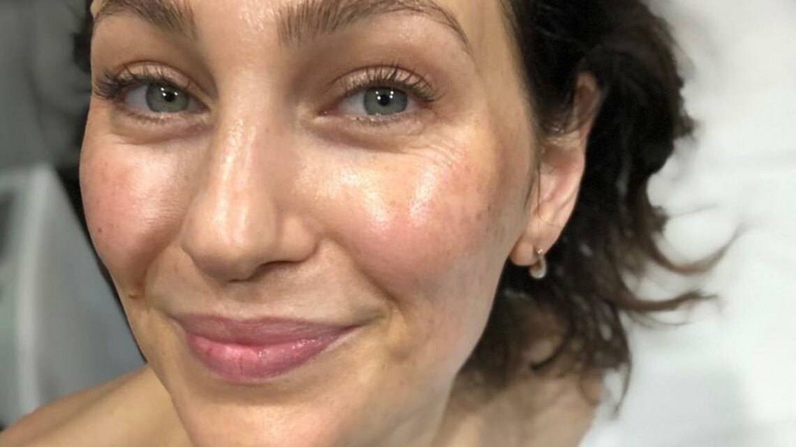 Pelle: Skincare per pelli grasse Pelle: Skincare per pelli grasse