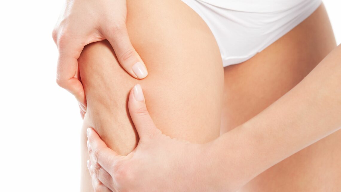 Onde d’Urto per combattere la cellulite: Cosa sapere Onde d’Urto per combattere la cellulite: Cosa sapere